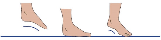 Обувь при плоскостопии